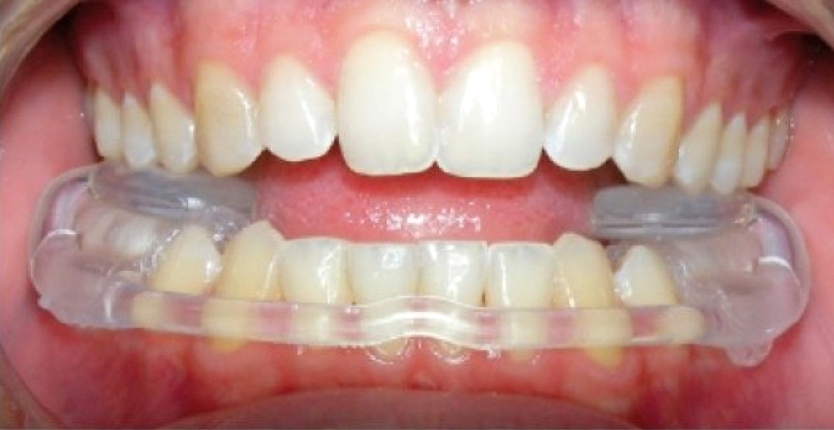 лечение протезирование зубов томск